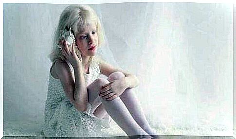 Girl suffering from albinism