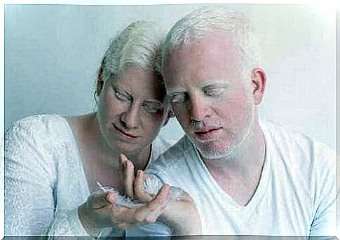 Couple with albinism